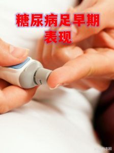 跑步控血糖要注意！冠心病肾病足患者不适合